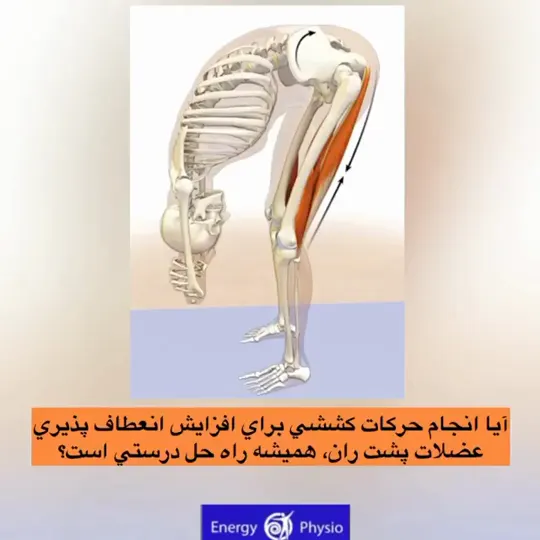 کوتاهی عضلات پشت ران (همسترینگ)
